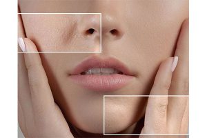 درمان منافذ باز پوست صورت و 12 روش کاربردی خانگی رفع آن